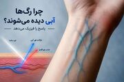 چرا رگ‌ها آبی دیده می‌شوند؟ پاسخ را فیزیک می‌دهد