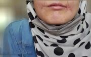 مرد مشهدی لب‌های زن ۱۸ ساله‌اش را دوخت