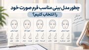 چطور مدل بینی مناسب فرم صورت خود را انتخاب کنیم؟
