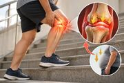 چرا زانو هنگام بالا رفتن از پله درد می‌گیرد و چه ارتباطی با اضافه‌وزن دارد؟