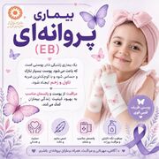 پوستر| بهزیستی حامی بیماران پروانه‌ای؛ تلاش برای بهبود کیفیت زندگی مبتلایان EB