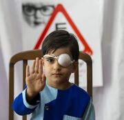 پوشش غربالگری تنبلی چشم کودکان گلستان به ۹۵ درصد می‌رسد