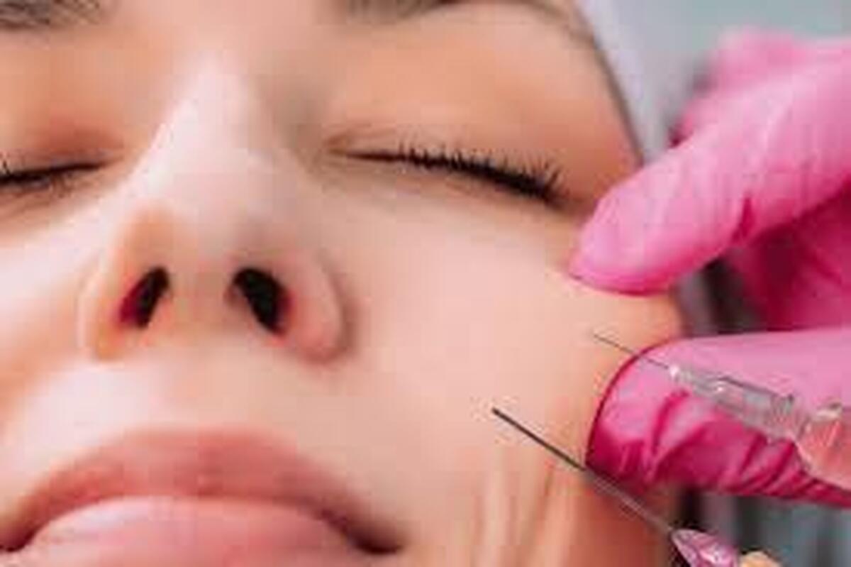 هشدار مهم درباره ژل‌های تزریقی زیبایی