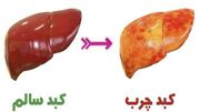 چگونه به کمک پاها از سلامت کبد مطلع شویم؟