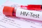 انجام آزمایش HIV به همگان توصیه می‌شود