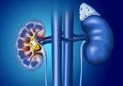 گرمای شدید و سرمای افراطی، دشمن پنهان کلیه‌ها