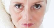 چطور پوست خود را بدون جراحی جوان و شاداب نگه داریم؟
