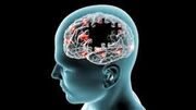 کشف متهم جدید آلزایمر و دارویی که پیش از آغاز فراموشی وارد عمل می‌شود