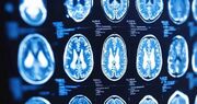 افزایش امنیت هوش مصنوعی در تحلیل MRI مغز با راه حل پژوهشگران ایرانی