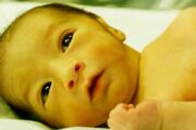 زردی نوزاد در ۲۴ ساعت نخست تولد را جدی بگیرید