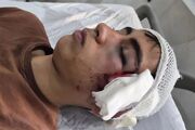 حادثه مصدومیت شدید دانش‌آموز دهبکری بم خبر ساز شد