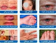 فراخوان شناسایی بیماران نیازمند جراحی پلاستیک و ترمیمی در جنوب غرب خوزستان
