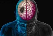 هر دقیقه در سکته مغزی حیاتی است