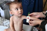 ۲۶۲ هزار کودک مبتلا به سوءتغذیه مشمول خرید سبد غذایی رایگان می شوند