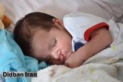 شکاف کام چیست و چگونه درمان می‌شود؟