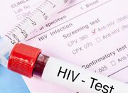 تست ایدز رایگان است/ HIV درمان می‌شود؟ - اکونیوز