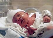 افزایش خطر زایمان زودرس با بیماری کبد چرب در بارداری - اکونیوز