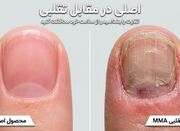 عوارض خاموش و هولناک مواد تقلبی کاشت ناخن؛ هشدار جدی به بانو... -