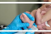 غربالگری نوزادان پیشگیری از عوارض مادام‌العمر کم‌کاری تیروئی... -