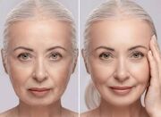 چه سرمی برای لیفت صورت خوبه؟ - اکونیوز