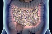 کشف تازه درباره دیابت نوع ۲ / باکتری‌های روده به کمک کنترل قند خون آمدند