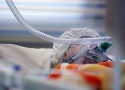 معاون وزیر بهداشت: حدود ۴۰۰ نفر از بیماران حوادث اخیر همچنان بستری و نزدیک به ۱۵۰ نفر در بخش‌های مراقبت‌های ویژه در حال درمان هستند؛ تعدادی نیز تحت عمل‌های جراحی سنگین قرار دارند