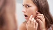 پوستت بعد از یک محصول جدید پر از جوش شده؟ این ۶ نشانه را بررسی کن