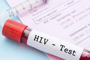 روش جدید پیشگیری از HIV؛ کاهش خطر ابتلا تا ۹۶ درصد