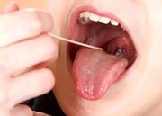 نقش لوزه‌ها در سیستم ایمنی بدن