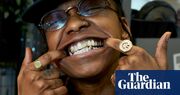 From £35 crystals to £30,000 diamonds: the jaw-dropping rise of tooth jewellery