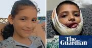 Mazyouna’s face was ‘ripped off’ when a rocket hit her home. Israel has refused to allow her evacuation