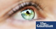 Keratopigmentation: why is eyeball tattooing on the rise?