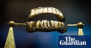 Shock of the old: 10 rotten and repugnant artefacts from dental history