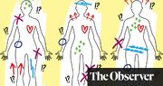 ‘We think of the body as a map’: a new approach to deciphering long Covid