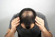 این شیرین کننده طبیعی از کچل شدن شما جلوگیری می کند