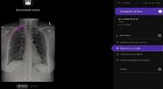همکاری تلفونیکا و Harryson.ai برای توسعه ابزاری مبتنی بر هوش مصنوعی برای تحلیل عکس‌برداری با اشعه ایکس از قفسه سینه