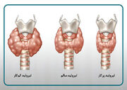 از نقش تیروئید در سلامت عمومی تا تأثیر ورزش، تشخیص و پیشگیری