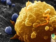 سرطان سینه فقط ژنتیکی نیست/تشخیص زودهنگام، کلید درمان موفق