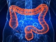 سرطان کولورکتال از شایع‌ترین سرطان‌ها در جهان و ایران است