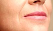 راهکارهای مناسب برای درمان چروک دور لب
