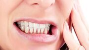 هشدار متخصص دندانپزشکی درباره عوارض جدی دندان‌قروچه