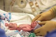 ۱۰ درصد نوزادان، نارس متولد می‌شوند
