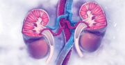 غربالگری کلیه؛ ضرورت همیشگی برای بیماران دیابتی