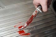 قتل دانشجوی دندانپزشکی در قزوین