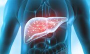با داشتن این علائم به کبد چرب مبتلا هستید