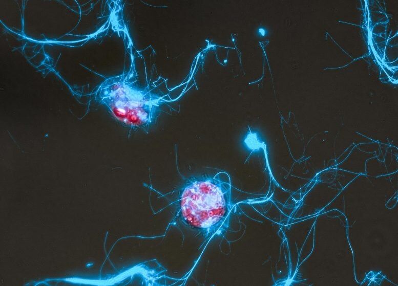 فیلمبرداری از مهمانی میکروبها در اقیانوس با کاوشگر مولکولی