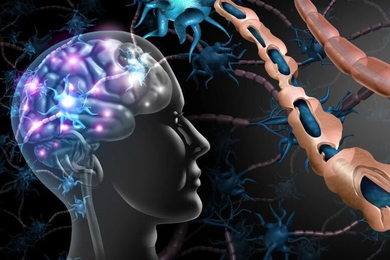 اِماِس ممکن است بیش از یک دهه پیش از بروز علائم آغاز شود