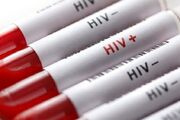 شناسایی 2 مورد جدید مبتلا به HIV در سقز