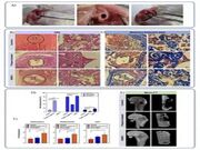 بهبود بازسازی استخوان با فناوری زیستی کم‌هزینه