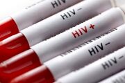 آزمایش رایگان و محرمانه HIV در مراکز مشاوره